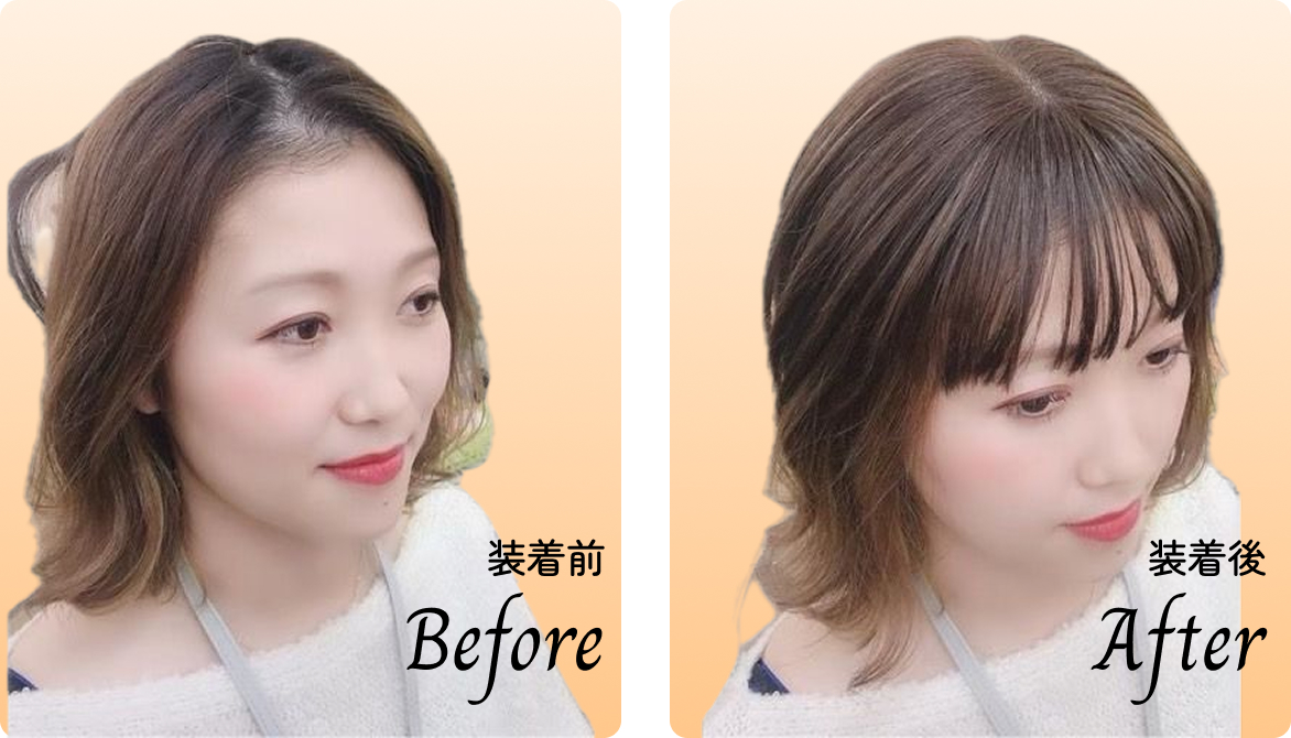 ビフォーアフター